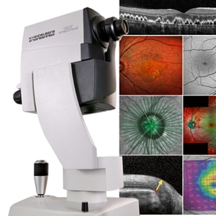 Tomografia de Coerência Óptica (OCT) - Heidelberg Spectralis
