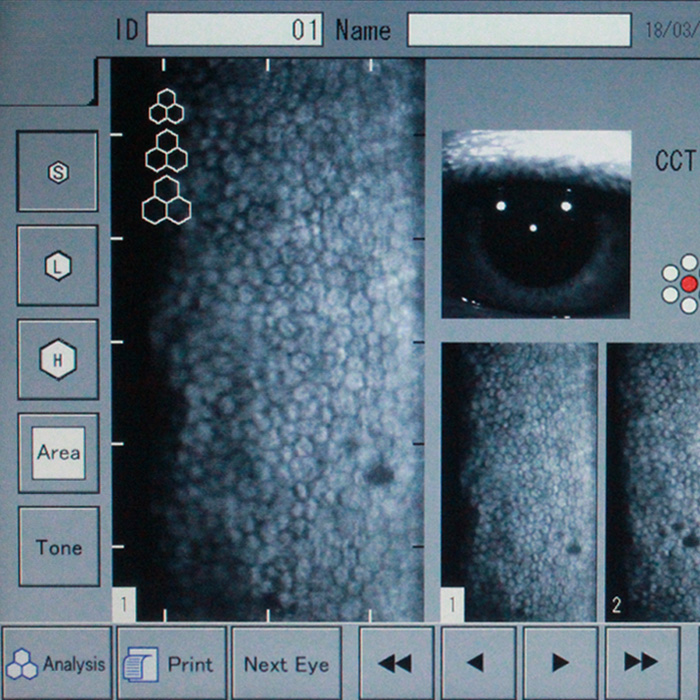 Microscopia Especular