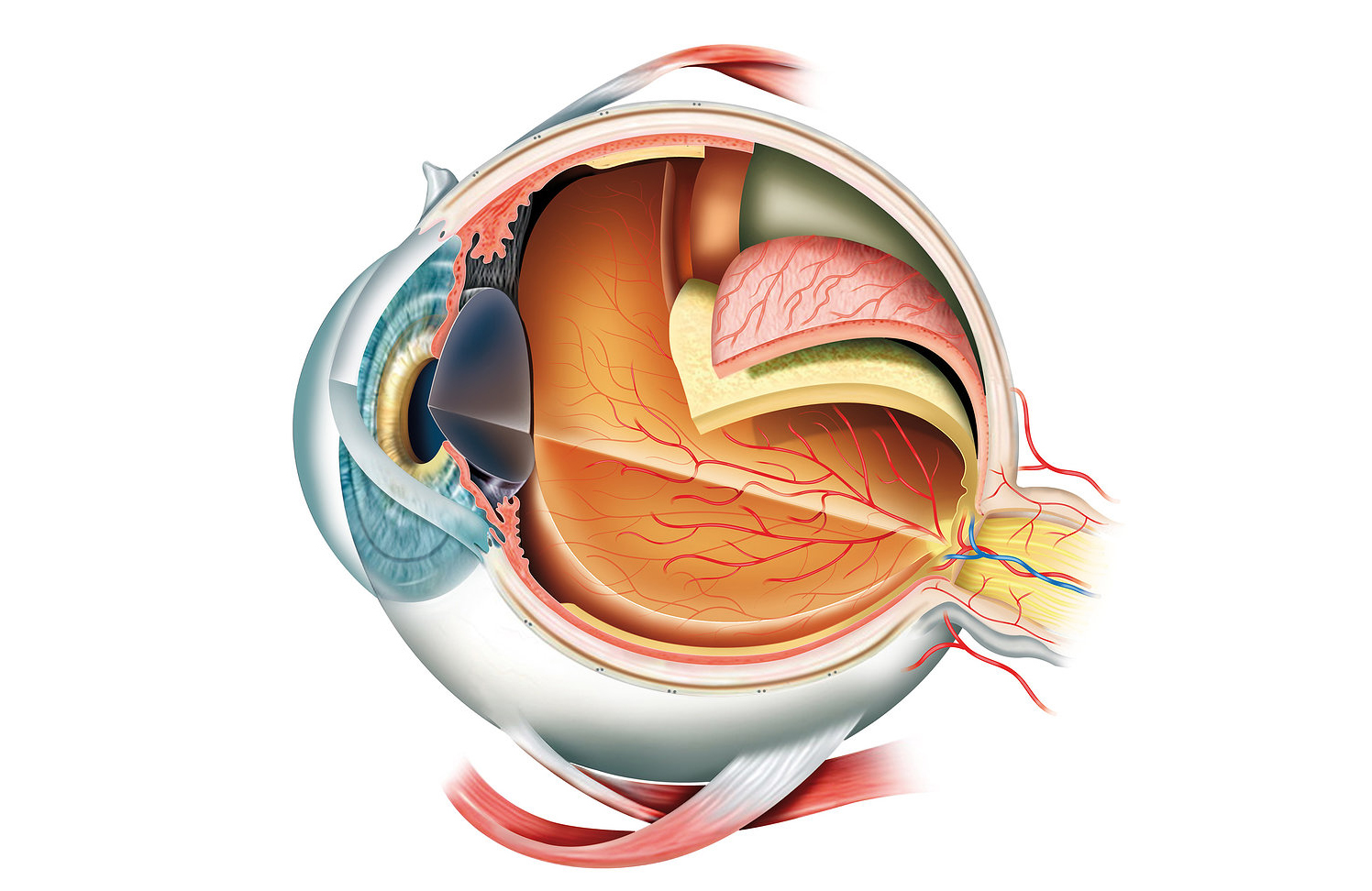 O que Ã© o Descolamento de Retina?